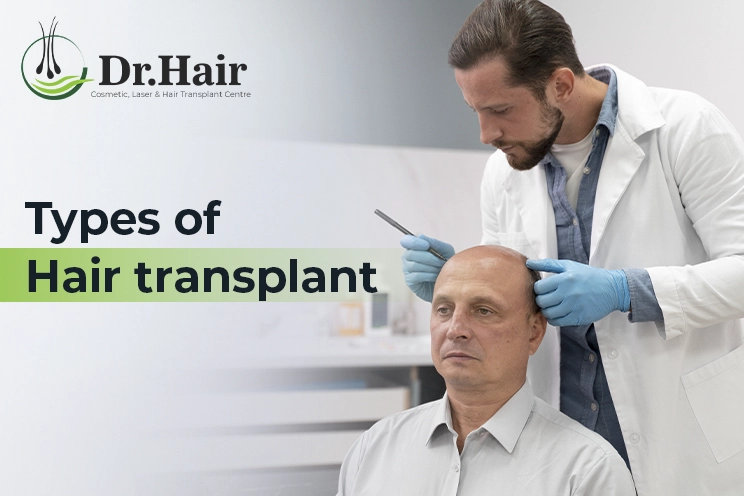 Types of Hair transplant